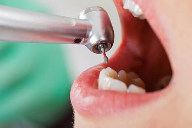 Best Dentist for Tooth Abscess  in South Fulton, TN